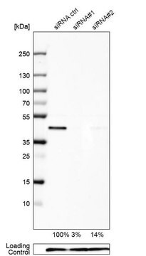 Anti-UBE2Z antibody produced in rabbit Prestige Antibodies&#174; Powered by Atlas Antibodies, affinity isolated antibody, buffered aqueous glycerol solution