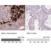 Anti-DBH antibody produced in rabbit Prestige Antibodies&#174; Powered by Atlas Antibodies, affinity isolated antibody