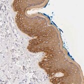 Anti-KRT17 antibody produced in rabbit Ab1, Prestige Antibodies&#174; Powered by Atlas Antibodies, affinity isolated antibody, buffered aqueous glycerol solution