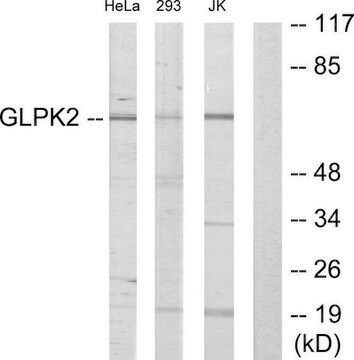 Anti-GK2 antibody produced in rabbit affinity isolated antibody