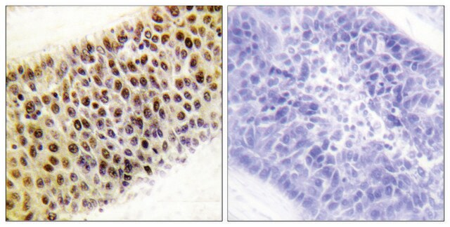 Anti-TIP60 antibody produced in rabbit affinity isolated antibody