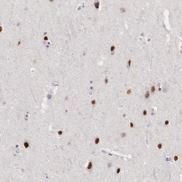 Anti-FOXP2 antibody produced in rabbit AB1, Prestige Antibodies&#174; Powered by Atlas Antibodies, affinity isolated antibody, buffered aqueous glycerol solution