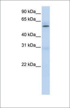 Anti-PRMT3 antibody produced in rabbit affinity isolated antibody