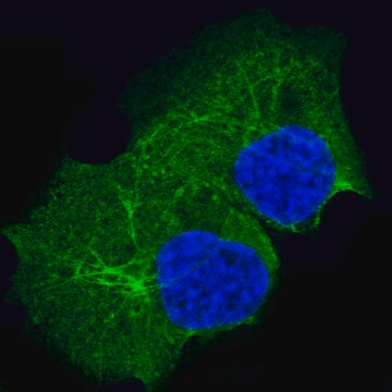 Monoclonal Anti-Krt14 Antibody Produced In Mouse Prestige Antibodies&#174; Powered by Atlas Antibodies, clone CL14568, affinity isolated antibody, buffered aqueous glycerol solution