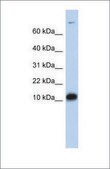Anti-FABP3 antibody produced in rabbit affinity isolated antibody