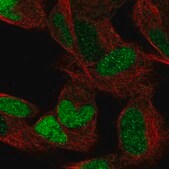 Anti-ESRRG antibody produced in rabbit Prestige Antibodies&#174; Powered by Atlas Antibodies, affinity isolated antibody, buffered aqueous glycerol solution