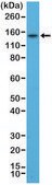 Anti-TPO (Thyroid Peroxidase) antibody, Rabbit monoclonal recombinant, expressed in HEK 293 cells, clone RM368, purified immunoglobulin