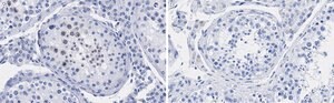 Anti-p14ARF Antibody, clone 4F19 ZooMAb&#174; Rabbit Monoclonal recombinant, expressed in HEK 293 cells