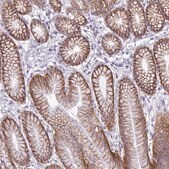Anti-ABCC3 antibody produced in rabbit Prestige Antibodies&#174; Powered by Atlas Antibodies, affinity isolated antibody, buffered aqueous glycerol solution