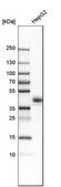 Anti-CXADR antibody produced in rabbit Prestige Antibodies&#174; Powered by Atlas Antibodies, affinity isolated antibody, buffered aqueous glycerol solution