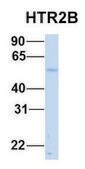 Anti-HTR2B (N-terminal) antibody produced in rabbit affinity isolated antibody