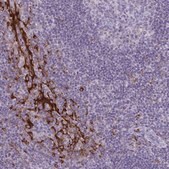 Anti-CARD9 antibody produced in rabbit Prestige Antibodies&#174; Powered by Atlas Antibodies, affinity isolated antibody, buffered aqueous glycerol solution
