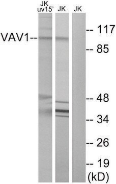 Anti-VAV1 antibody produced in rabbit affinity isolated antibody