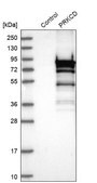 Anti-PRKCD antibody produced in rabbit Ab2, Prestige Antibodies&#174; Powered by Atlas Antibodies, affinity isolated antibody, buffered aqueous glycerol solution