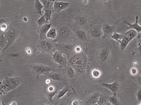 UM-SCC-105 Human Squamous Carcinoma Cell Line