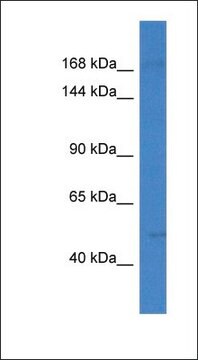 Anti-SETD5 antibody produced in rabbit affinity isolated antibody