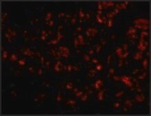 Anti-Albumin antibody produced in chicken affinity isolated antibody, buffered aqueous solution