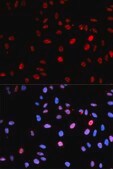 Anti-Phospho-p53-S15 antibody produced in rabbit