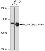 Anti-Tubulin beta-1 chain Antibody, clone 2Z6P1, Rabbit Monoclonal