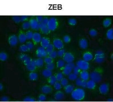 Anti-ZEB1 (N-terminal) antibody produced in rabbit affinity isolated antibody
