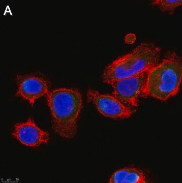 Anti-ALK-7 Antibody, clone 1N5 ZooMAb&#174; Rabbit Monoclonal recombinant, expressed in HEK 293 cells