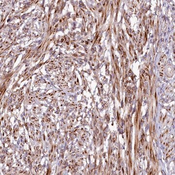 Anti-SSC5D antibody produced in rabbit Prestige Antibodies&#174; Powered by Atlas Antibodies, affinity isolated antibody, buffered aqueous glycerol solution