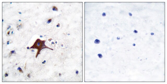 Anti-GLUT3, C-Terminal antibody produced in rabbit affinity isolated antibody