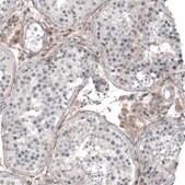 Anti-CHRM3 antibody produced in rabbit Prestige Antibodies&#174; Powered by Atlas Antibodies, affinity isolated antibody, buffered aqueous glycerol solution