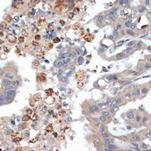 Anti-PRSS2 antibody produced in rabbit