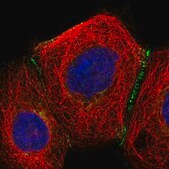 Anti-SLC9A2 antibody produced in rabbit Prestige Antibodies&#174; Powered by Atlas Antibodies, affinity isolated antibody, buffered aqueous glycerol solution
