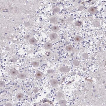 Anti-CENPQ antibody produced in rabbit Prestige Antibodies&#174; Powered by Atlas Antibodies, affinity isolated antibody, buffered aqueous glycerol solution