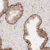 Anti-CXADR antibody produced in rabbit Prestige Antibodies&#174; Powered by Atlas Antibodies, affinity isolated antibody, buffered aqueous glycerol solution, ab2