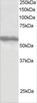 Anti-TRIM4 antibody produced in goat affinity isolated antibody, buffered aqueous solution