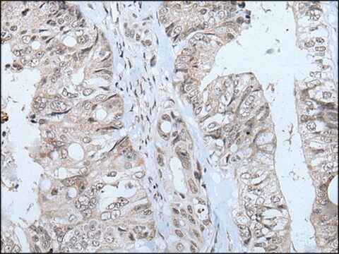 Anti-MTHFR affinity isolated antibody