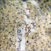 Anti-phospho-BAD (pSer112) antibody produced in rabbit affinity isolated antibody