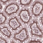 Anti-UBN1 antibody produced in rabbit Prestige Antibodies&#174; Powered by Atlas Antibodies, affinity isolated antibody, buffered aqueous glycerol solution