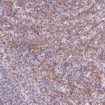 Anti-IFNGR1 antibody produced in rabbit Prestige Antibodies&#174; Powered by Atlas Antibodies, affinity isolated antibody, buffered aqueous glycerol solution