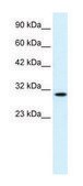 Anti-CDC2 (C-terminal) antibody produced in rabbit affinity isolated antibody
