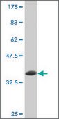 Monoclonal Anti-UBE3A antibody produced in mouse clone 3E5, purified immunoglobulin, buffered aqueous solution