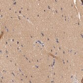 Anti-HGS antibody produced in rabbit Prestige Antibodies&#174; Powered by Atlas Antibodies, affinity isolated antibody, buffered aqueous glycerol solution