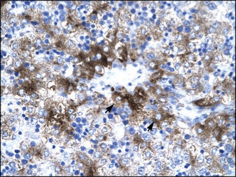 Anti-PIAS3 antibody produced in rabbit IgG fraction of antiserum