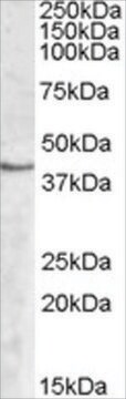 Anti-SPHK1 antibody produced in goat affinity isolated antibody, buffered aqueous solution