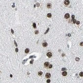 Anti-BCLAF1 antibody produced in rabbit Prestige Antibodies&#174; Powered by Atlas Antibodies, affinity isolated antibody, buffered aqueous glycerol solution
