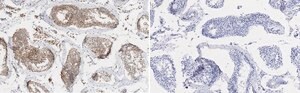 Anti-&#946; Tubulin Antibody, clone 10G11 ZooMAb&#174; Rabbit Monoclonal recombinant, expressed in HEK 293 cells