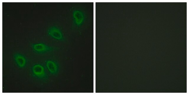 Anti-ENOS antibody produced in rabbit affinity isolated antibody