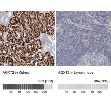 Anti-AGXT2 antibody produced in rabbit Prestige Antibodies&#174; Powered by Atlas Antibodies, affinity isolated antibody, buffered aqueous glycerol solution