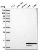 Anti-HBA1 antibody produced in rabbit Prestige Antibodies&#174; Powered by Atlas Antibodies, affinity isolated antibody, buffered aqueous glycerol solution