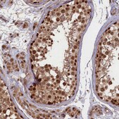 Anti-BRCA1 antibody produced in rabbit Prestige Antibodies&#174; Powered by Atlas Antibodies, affinity isolated antibody, buffered aqueous glycerol solution