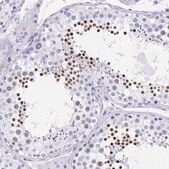 Anti-HDGFL1 antibody produced in rabbit Prestige Antibodies&#174; Powered by Atlas Antibodies, affinity isolated antibody, buffered aqueous glycerol solution