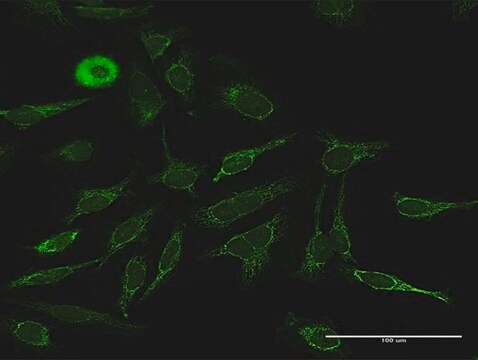 Anti-PDK4 antibody produced in rabbit purified immunoglobulin, buffered aqueous solution